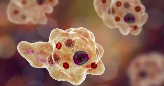 amoebic-encephalitis-1200x630.jpg-EwQoJUvPuM.webp