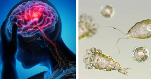 brain virus-8GqhjaTXQ1.webp