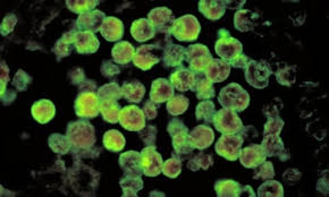 images (11)-Ei2HDsfy7c.jpg